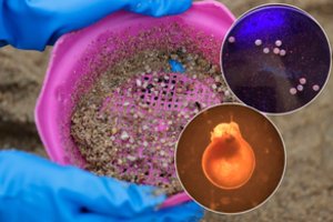 Įspėja apie nematomą krizę – šios medžiagos randa įvairiausiuose kūno organuose