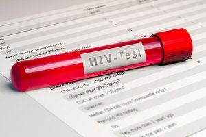 Netikėtas šalutinis efektas: išgijo nuo ŽIV