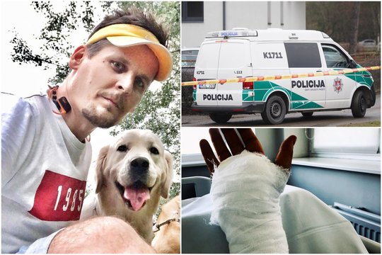 Po žiauraus užpuolimo vos gyvas likęs klaipėdietis nebegali tylėti: „Toliau leisit tokiems ligoniams būti tarp mūsų?“