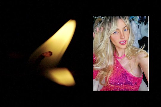 Paaiškėjo, dėl ko mirė apvalią sumelę 27 operacijoms išleidusi „Gyva Barbė“