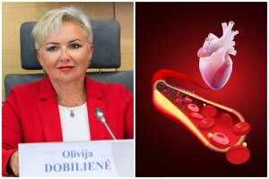 Žmonės klaidingai mano, kad jų cholesterolis „geras“: kokia koncentracija iš tiesų nepavojinga