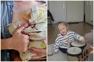 Medikai prognozavo, kad dvynukės gims negyvos: 30 operacijų ištvėrusi Kamilė negali verkti, bet kovoja už save