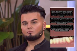 Vytenis Partikas nusivylė odontologo darbu: parodė, kas liko iš dantų