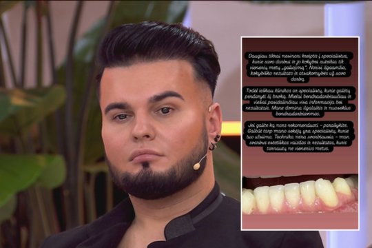 Vytenis Partikas nusivylė odontologo darbu: parodė, kas liko iš dantų