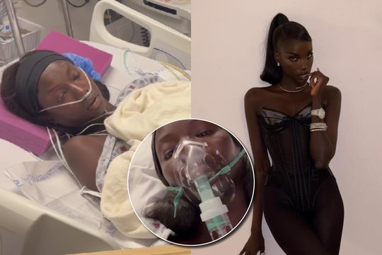 28-erių modeliui netikėtai diagnozuota klastinga liga: simptomai pasireiškė tik po ilgo laiko