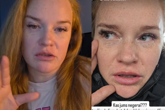 Paviešinusi šiurpą sukėlusią patirtį D. Virbilaitė sulaukė piktų internautų kirčių: „Ar jums viskas gerai su galva?“