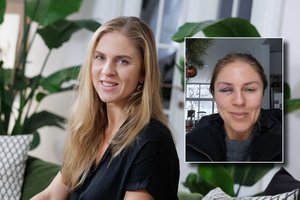 Edita Užaitė patyrė traumą: paaiškėjo, kas nutiko