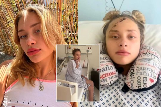 Po ilgos tylos – žinia apie Dubajuje sunkiai sužalotą manekenę Mariją Kovalčiuk