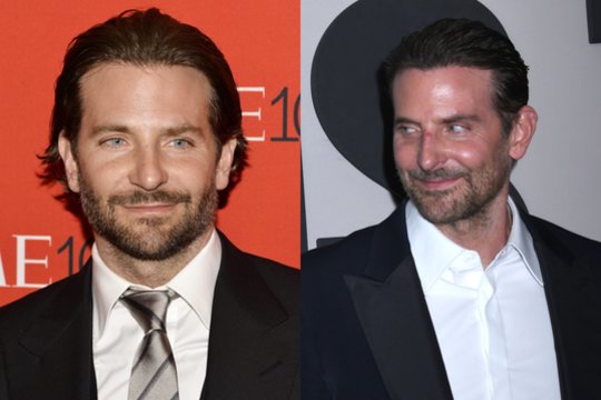 Po kalbų apie atliktas plastines operacijas – mįslinga Bradley Cooperio reakcija