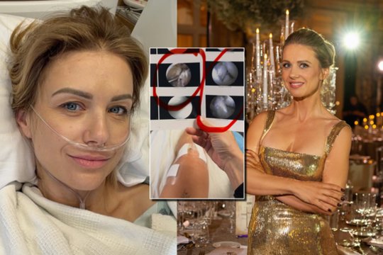 Modesta Vžesniauskaitė atsidūrė medikų rankose: patyrė itin rimtą traumą