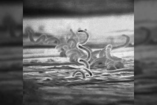 Naujas atradimas keičia tai, kas buvo žinoma apie sifilį