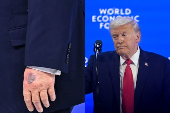 D. Trumpo ranka – ir vėl dėmesio centre: pateikė savo paaiškinimą