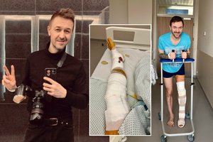 Populiari žiemos pramoga fotografui M. Žičiui baigėsi daugybiniais lūžiais ir operacija: perspėja kitus