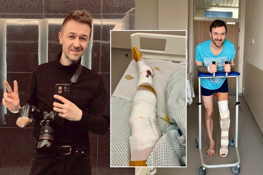 Populiari žiemos pramoga fotografui M. Žičiui baigėsi daugybiniais lūžiais ir operacija: perspėja kitus