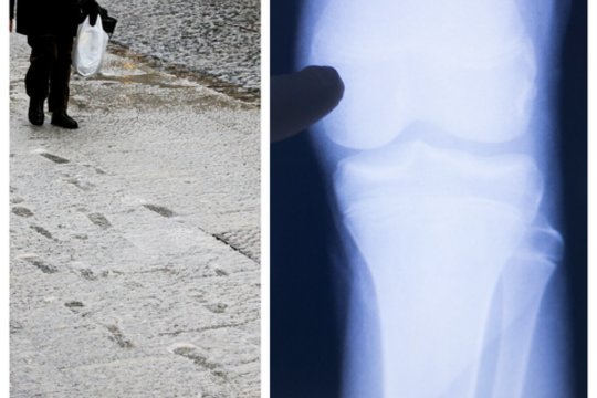 Vilnietė niršta: Lenkijoje uždaromos mokyklos, o vilniečiai vietoje pamokų vyksta darytis rentgeno