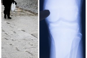 Vilnietė niršta: Lenkijoje uždaromos mokyklos, o vilniečiai vietoje pamokų vyksta darytis rentgeno