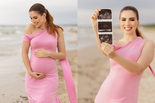 Sotera Šveikauskaitė pagimdė trečią mergaitę