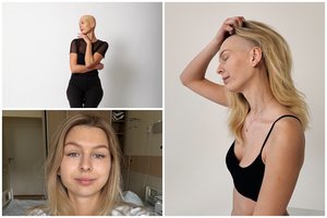 Vos 25-erių Joanai smogė sunki liga: „Tik pradėjau kurti savo gyvenimą ir susirgau“