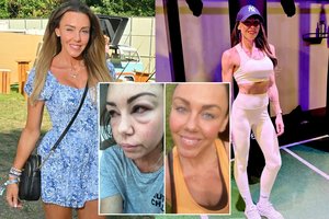 Su priklausomybėmis kovojusi M. Heaton – sunkiai atpažįstama: prakalbo apie išgyventą pragarą