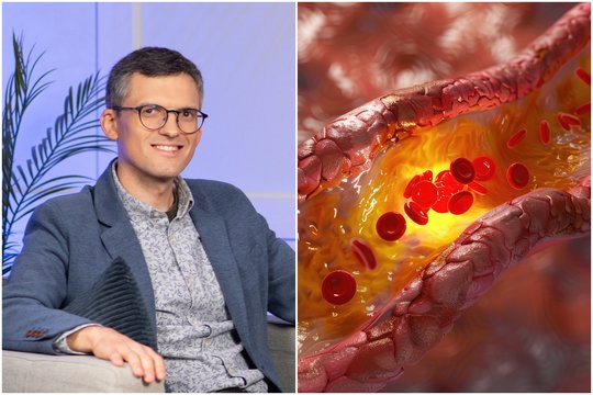 Mokslininkas T. Vaičiūnas įvardijo dažną klaidą: kodėl fizinis aktyvumas nesumažins cholesterolio