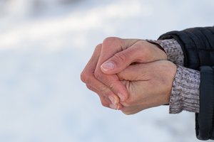 Patarė, kaip atšildyti nušalusią odą: nedarykite šiurkščios klaidos