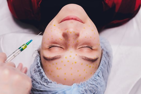 Estetinės ir vitaminų injekcijos – greito efekto pažadas ar pavojinga mada?