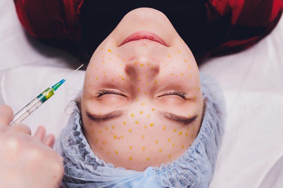 Estetinės ir vitaminų injekcijos – greito efekto pažadas ar pavojinga mada?