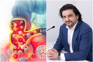 Chirurgas A. Dulskas įvardijo vėžį, kuriuo vis dažniau suserga žmonės iki 50 metų