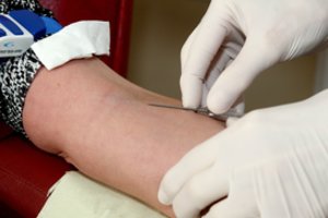 Skelbiama, kad į biologinės stebėsenos tyrimą atvyko tik penktadalis kviestų gyventojų