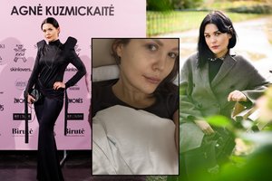 Menininkė Monika Dirsytė atsidūrė ligoninėje: atlikta operacija