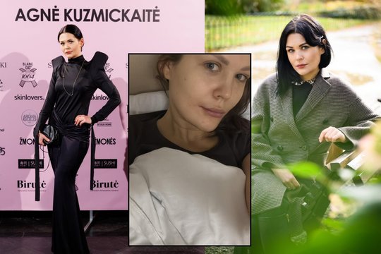 Menininkė Monika Dirsytė atsidūrė ligoninėje: atlikta operacija
