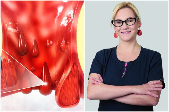 „Kraujas purškia kaip iš čiaupo“: chirurgė prašo suklusti – šios ligos pikas 45–65 metai
