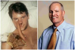 Gražuoliu laikytas jaunuolis po operacijos nepažino savęs: „Nuo mano skruosto iki krūtinės ėjo odos vamzdis“