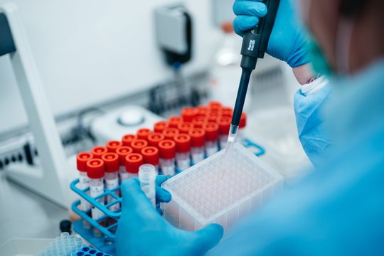 Dilema dėl genetinio testo: ar noriu sužinoti, kad sergu Huntingtono liga?