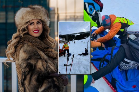 Slovakijoje slidinėjusi lietuvė patyrė košmarą – į ją trenkėsi dideliu greičiu trenkęsis slidininkas: „Svarbiausia – aš gyva“