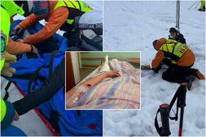 Incidentas Slovakijoje lietuvės gyvenimą apvertė aukštyn kojom: „Negaliu judėti net su ramentais“