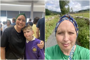 Pusamžė mokytoja susirgo smegenų vėžiu: pirmas simptomas atrodė visai nebaisus