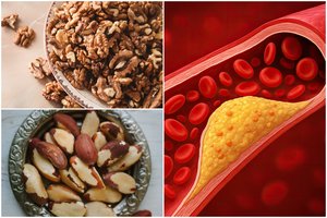 Geriausias riešutas širdies sveikatai? Vos 30 gramų sumažina „blogąjį“ cholesterolį