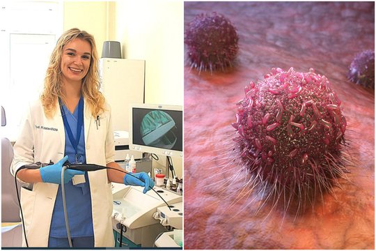 Įsidėmėkite: gydytoja išvardijo netikėtus vėžio požymius