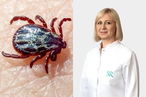 Vienus žmones erkės „mėgsta“ labiau: gydytoja paaiškino, kam ypač svarbu pasiskiepyti nuo erkinio encefalito
