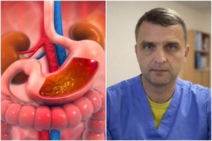 Esminis skrandžio vėžio sukėlėjas – tai pripažintas kancerogenas