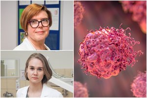 Gydytojos prašo suklusti: išskirtinis vėžys, kurio požymiai matyti plika akimi