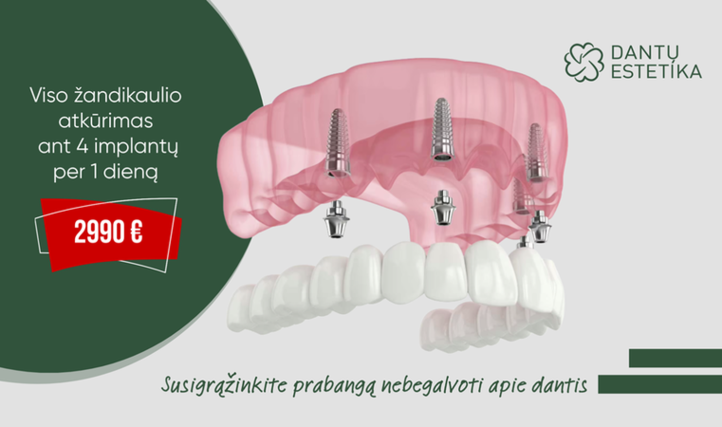  Kiekviena situacija yra individuali, todėl „Dantų estetikos“ specialistai kviečia ne spėlioti, o pasikonsultuoti.