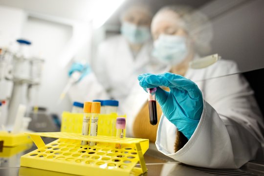 Daugėjant sergančiųjų, Lietuvoje bus kuriami dirbtinio intelekto modeliai retų ligų diagnostikai