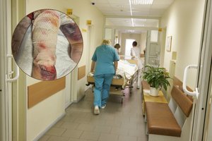 Po viešnagės Rokiškio ligoninėje – baisus vaizdas: medikai sužalojo senjorę?