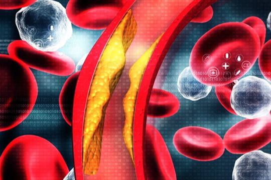 Gėrimas, kuris mažina cholesterolį: užtenka vienos stiklinės per dieną