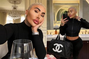 Rastas negyvas plastinėmis operacijomis išgarsėjęs 34-erių vyras: mirtį gaubia mįslingos aplinkybės