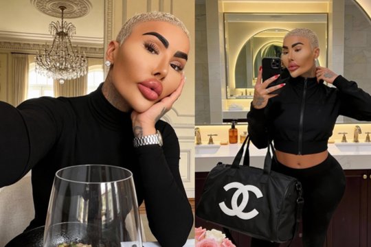 Rastas negyvas plastinėmis operacijomis išgarsėjęs 34-erių vyras: mirtį gaubia mįslingos aplinkybės