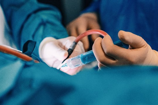 Kauno klinikose pradėtas taikyti pažangus metodas prieširdžių virpėjimui gydyti