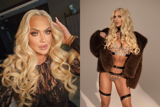 Žinomai plaukų priauginimo meistrei Revekai Devolskytei atlikta plastinė operacija